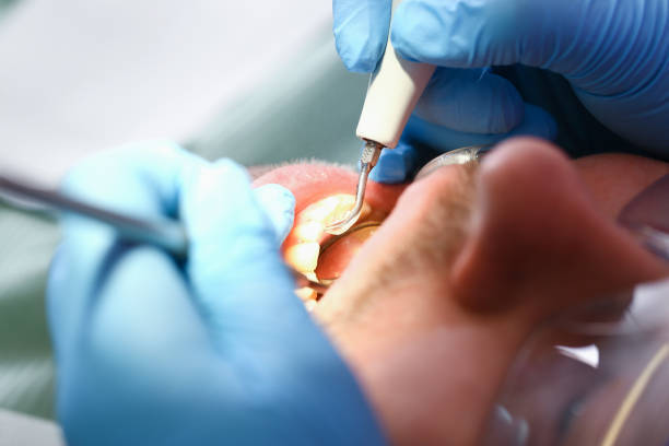 Best Cracked Tooth Emergency Dentist  in Hamlet, IN